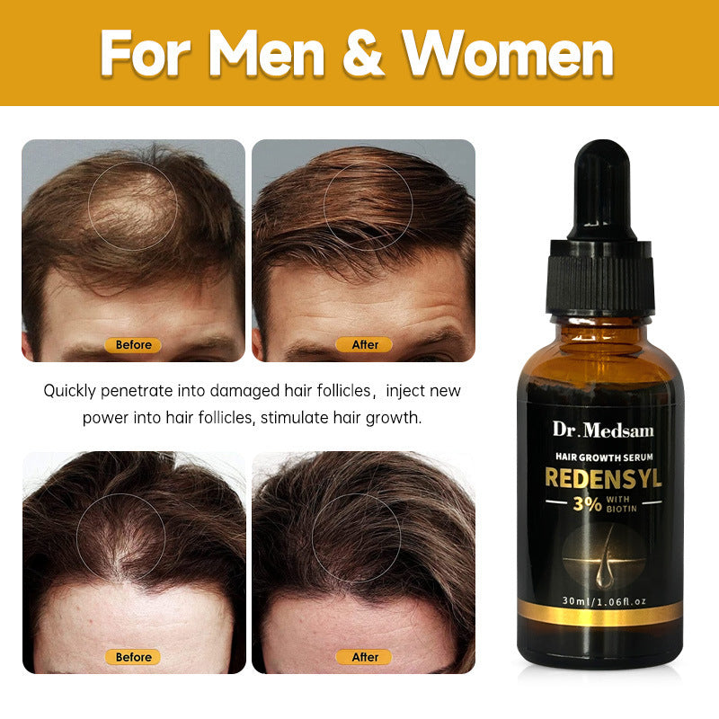 Biotin Hair Growth Oil with Rosemary for Thicker, Fuller Hair – 30ml