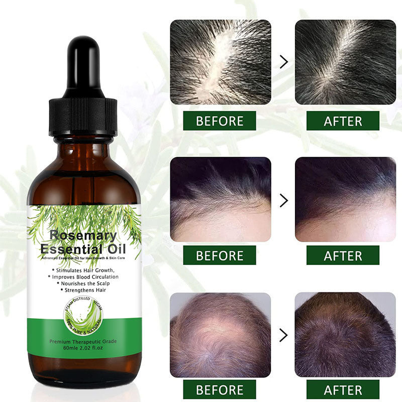 Rosemary Hair Growth Serum – Repair Split Ends, Reduce Frizz & Heat Damage – 60ml for All Hair Types