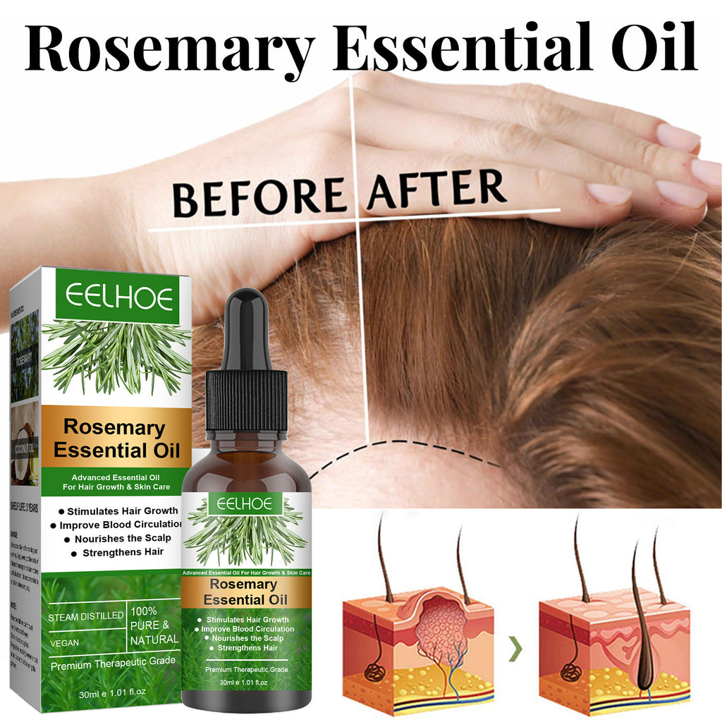 Rosemary Hair Growth Oil for Export – Anti-Loss Scalp Treatment with Argan & Coconut Oil | 30ml